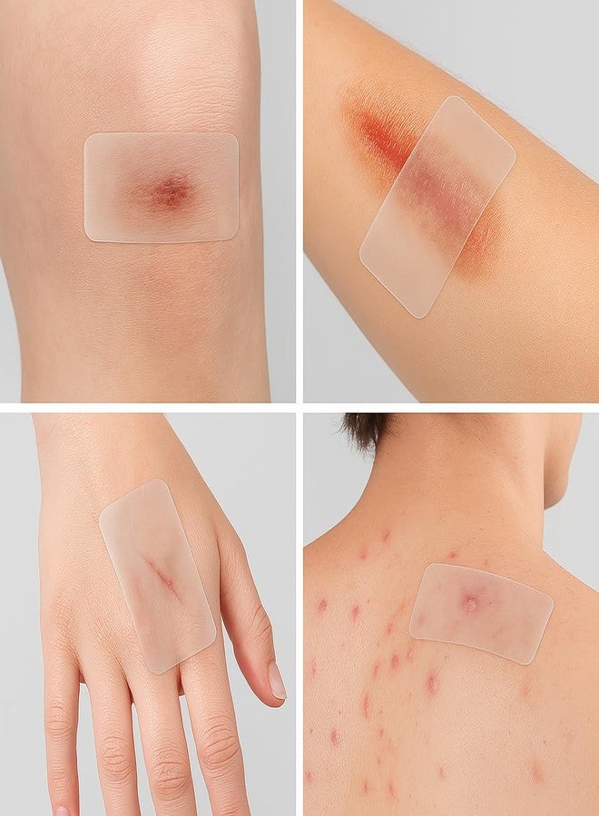 PUREEASE Clear Scar Sheets – 10 Pieces – Skin Patches for Face and Body – Use Before Scars Fully Form – Prevent and Reduce Scars from Acne, Scalds, Burns, Cuts, Abrasions – Thin, Flexible, Waterproof, Gentle - Image 4